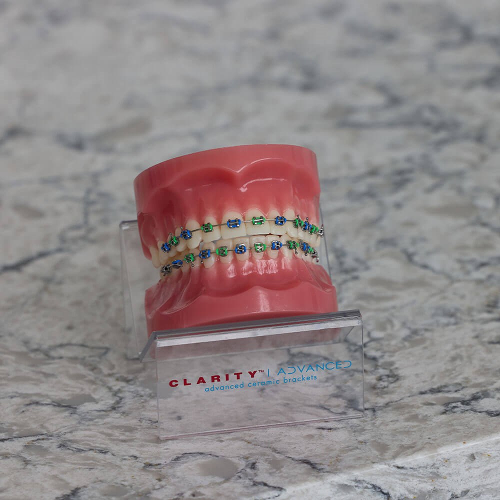 Braces